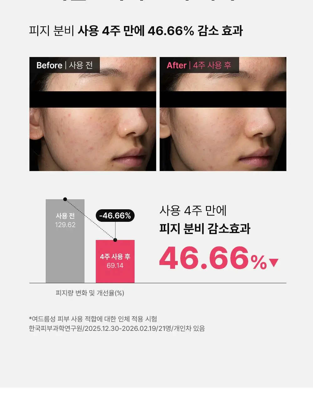 (하루특가)[단독기획] 동아제약 아크네 프로 크림제 30ml 기획(+3ml+겔제3ml) 상세페이지 13